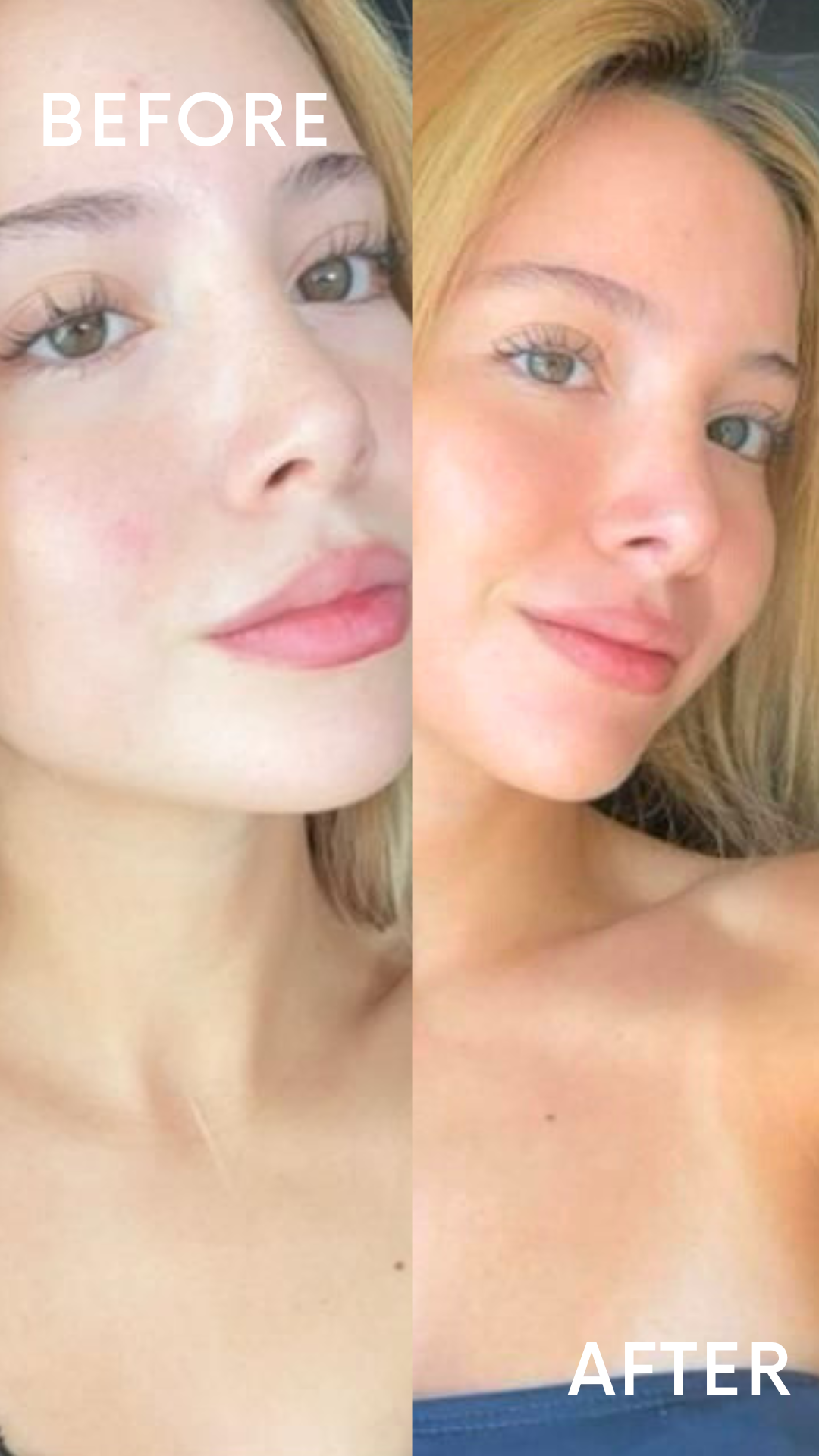 Autobronceante facial Sun Drops